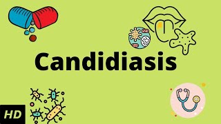 CANDIDIASIS Causes Signs and Symptoms Diagnosis and Treatment [upl. by Eastlake]