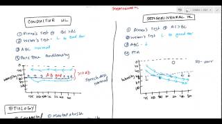 Intermediate Accounting Discussion 11  Property Plant and Equipment 4 [upl. by Burne330]