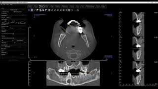 Invivo 6  ArchSection View Tab [upl. by Riegel]