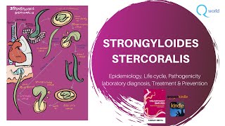 Strongyloides stercoralis Parasitology simplified tutorials For NEXT USMLE NEET PG PLAB [upl. by Aihseyk]