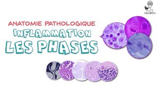 Anatomie Pathologique  Phases de lInflammation [upl. by Ause]