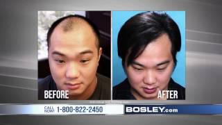 Tired of Losing Your Hair  Bosley Commercial [upl. by Lontson]