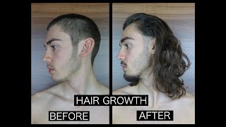 HAIR GROWTH TIME LAPSE  SIDE [upl. by Loring653]