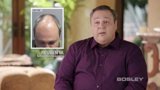 Bosley Hair Transplant Patient Review  Reuben M [upl. by Ledba466]