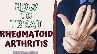 Reversing Rheumatoid Arthritis with Dr David Brady Reversing Arthritis symptoms [upl. by Olraced408]