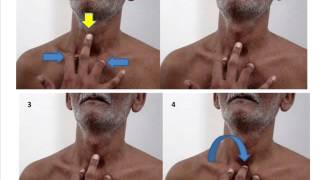 Palpation of trachea  outline of steps [upl. by Chapman726]