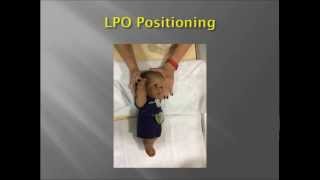 Pediatric Upper GI Fluoroscopy exam [upl. by Lukasz]