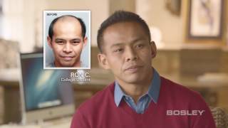 Bosley Hair Transplant Patient Review  Ron C [upl. by Noram517]