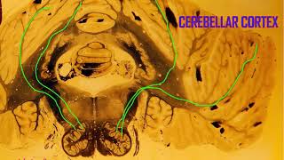 Purkinje cells in the cerebellum [upl. by Shae]