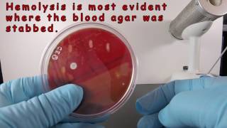 Beta Hemolysis on Blood Agar [upl. by Sredna]