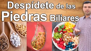 COMO ELIMINAR LAS PIEDRAS EN LA VESICULA ¿SIN OPERACIÓN  Adiós Calculos Biliares Para Siempre [upl. by Enelram]