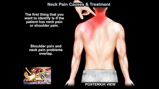 Common Causes of Neck Pain [upl. by Fates142]