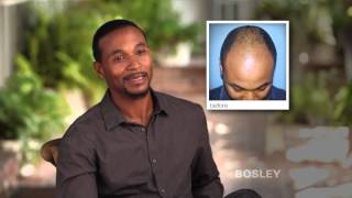 Bosley Hair Restoration Patient Review  Gerald R [upl. by Aldos]