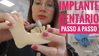 Implante Dentário Passo a Passo l Dra Danielle Sales [upl. by Attenehs]