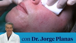 Mi primera cita con la dermatóloga [upl. by Hajin277]