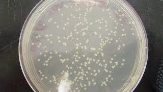 CFU Colony Forming Unit amp cfuml calculation [upl. by Atrebla899]