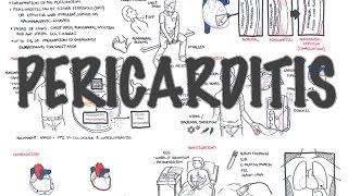 Pericarditis  Overview signs and symptoms pathophysiology diagnosis treatment [upl. by Eikcuhc]