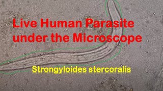 Human Parasites Live under the Microscope  Strongyloides stercoralis [upl. by Gus]