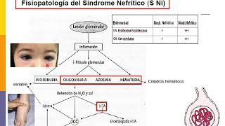 SÍNDROME NEFRÍTICO  DEFINICIÓN ETIOLOGÍA FISIOPATOLOGÍA DIAGNÓSTICO Y TRATAMIENTO [upl. by Ecyoj]