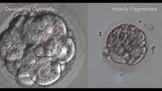 IVF Embryo development in the lab amp PGT Part 3 [upl. by Revlis151]