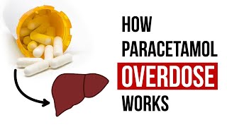 How Paracetamol Overdose Works [upl. by Claiborne]