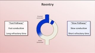 Intro to EKG Interpretation  Mechanisms of Tachyarrhythmias [upl. by Travers]