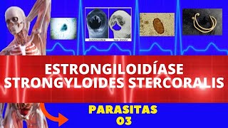 ESTRONGILOIDÍASE  STRONGYLOIDES STERCORALIS VERMINOSE  PARASITOLOGIA  INFECTOLOGIA [upl. by Neik731]