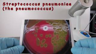 Alpha Hemolysis and Identification of Streptococcus pneumoniae [upl. by Ijan475]