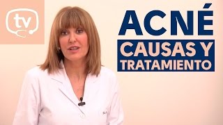 Como Aplicar mi tratamiento del Acne [upl. by Eimilb]