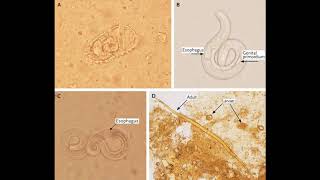 Strongyloides stercoralis  morphology life cycle pathogenesis diagnosis and treatment [upl. by Suoinuj]