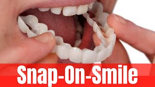 Prótese Removível Snap on Smile [upl. by Shriner]